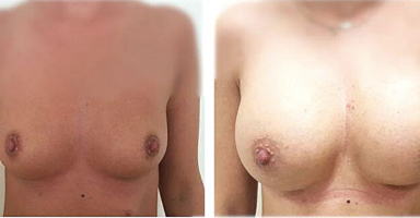 dr ryszard nawrocki powiększenie piersi